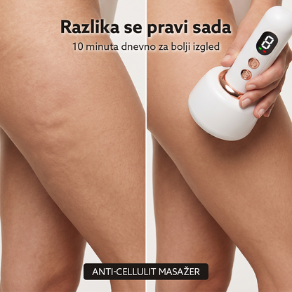 Električni anti-celulit vakum masažer sa crvenim i plavim svetlom