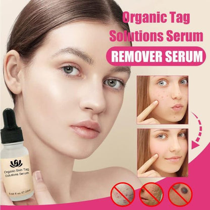 Organic Solutions Serum za uklanjanje nesavršenosti na koži