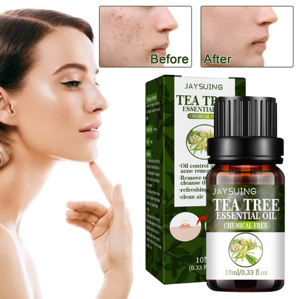 TEA TREE OIL - Ulje protiv akni