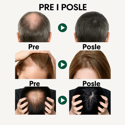 Eelhoe - Serum protiv opadanja i brži rast kose